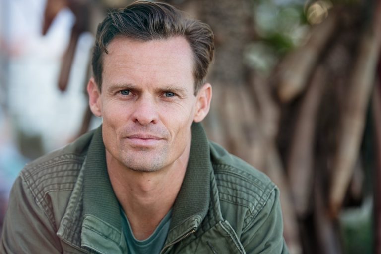 Opadająca powieka – korekta bez skalpela dla najbardziej wymagających